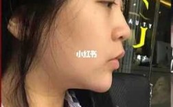 韩国哪些医院做鼻部综合手术比较专业？有哪些需要注意的问题,韩式隆鼻哪里好看