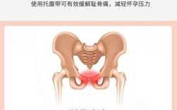 孕妇耻骨在哪里图片「孕妇耻骨疼一般发生在几个月」