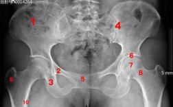 女性耻骨X光片怎么看,女性耻骨准确位置