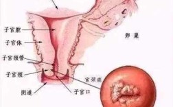 宫颈癌是长在那个部位的,宫颈长在哪里位置图片
