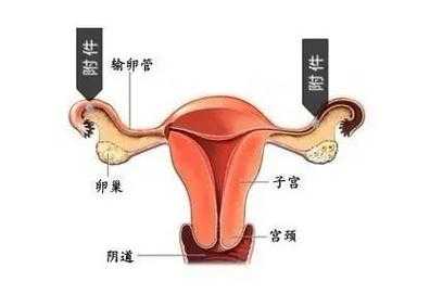 输卵管发炎哪里会疼图片女性-图1