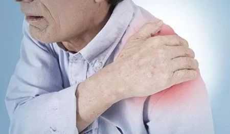 肩周炎哪里疼（肩周炎的症状有哪些呢）-图2
