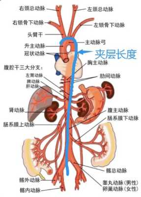 腹主动脉腹壁血栓怎样治疗,腹主动脉在哪里分为左右髂总动脉-图1