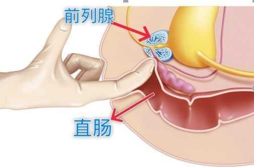 前列腺位于哪里（前列腺检查，是什么科室）-图1