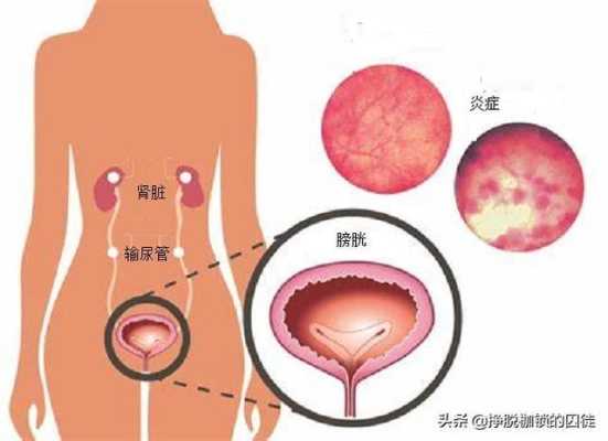 女性的尿道在哪里（女性的尿道在哪里）-图3