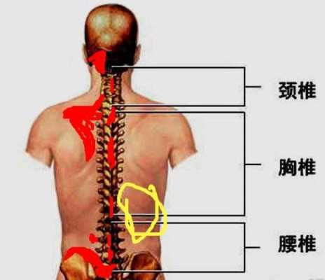 腰疼是哪里（导致腰骶部疼痛的原因有哪些）-图3