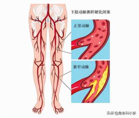 动脉血管在哪里（腿上的大动脉在哪里）-图3