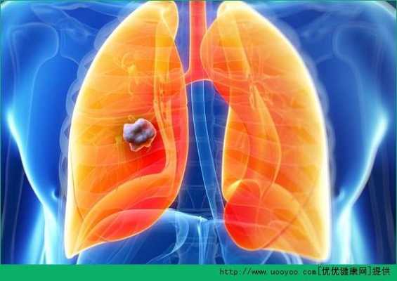 肺长在哪里（肺有再生功能吗）-图3