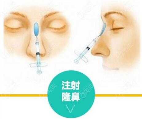 玻尿酸隆鼻效果好吗，除了使用玻尿酸，还有什么其他的方法可以隆鼻的,隆鼻哪里做的好一点-图1