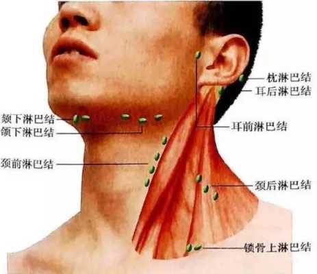 颈部淋巴是什么原因导致的,脖子淋巴结在哪里部位图片-图2