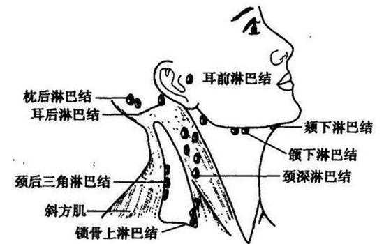 颈部淋巴是什么原因导致的,脖子淋巴结在哪里部位图片-图3