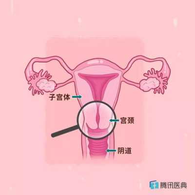 宫颈管在哪里（阴道、子宫的位置在哪里）-图2