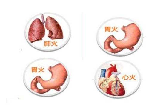 胃火过旺会有哪些表现,胃底在哪里位置图-图1