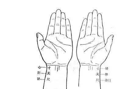 把脉把哪里（中医诊脉，把一只手，还是两只手？有的中医为什么只把一只手）-图3