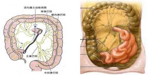 腹腔内淋巴结什么意思,腹部淋巴在哪里图片-图2