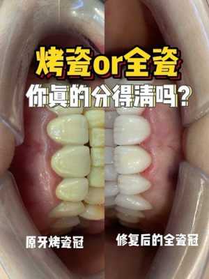 什么是美容牙,牙齿美容去哪里比较好-图2