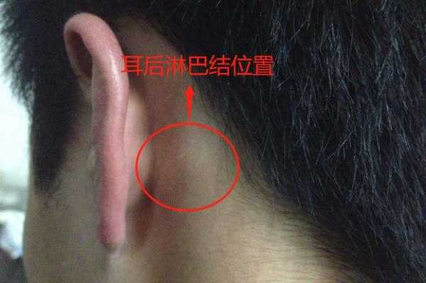 耳垂下面那个位置有一个小淋巴结是为什么啊,耳朵的淋巴结在哪里图片-图1