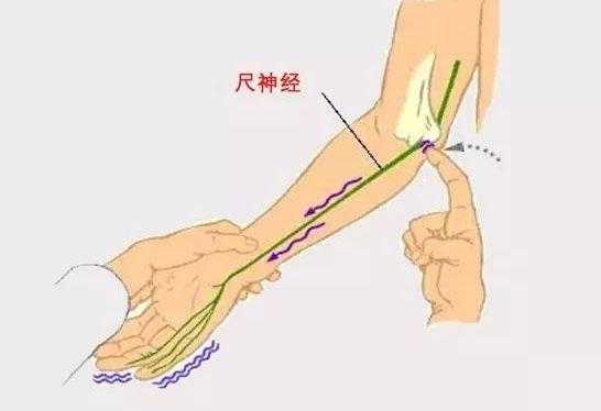 手臂上的麻筋的位置,手臂麻筋在哪里-图1