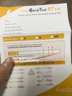 测血型多少钱,哪里测血型快-图2