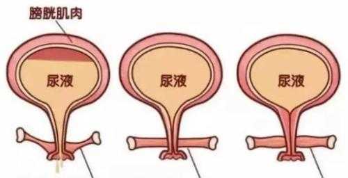 女性尿道和阴道的位置在哪里,女性尿是从哪里出来的?叫做什么-图3