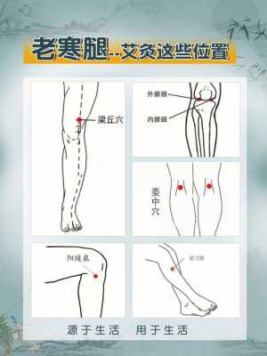 腿酸痛艾灸哪里（腿酸痛艾灸哪里好一点）-图2